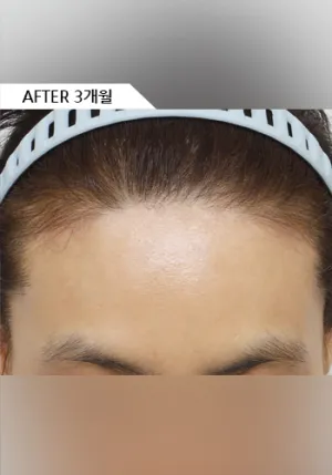 After