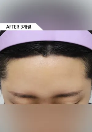After