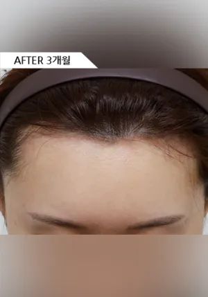 After