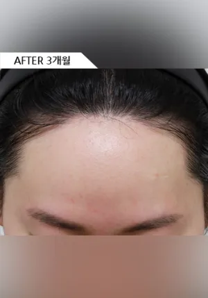 After