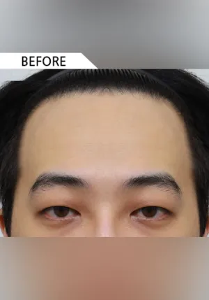 Before