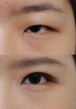 After
