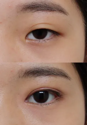 After