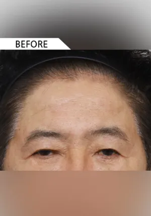 Before