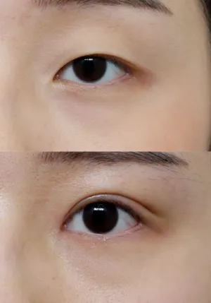 After
