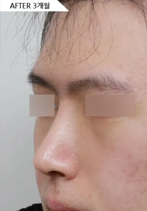 After