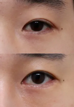 After
