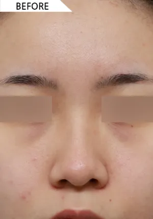 Before