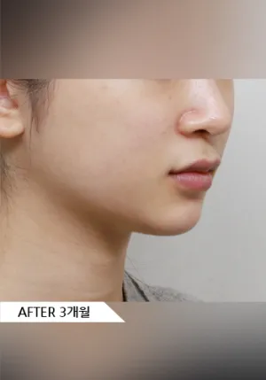 After
