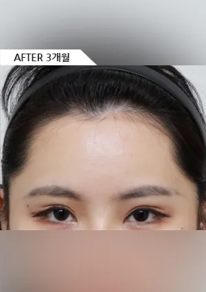 After