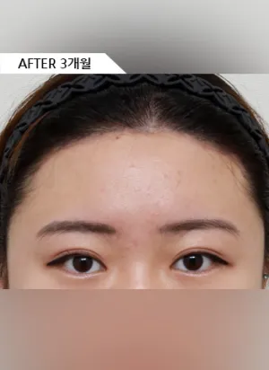 After