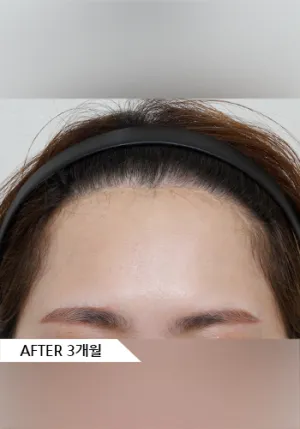 After