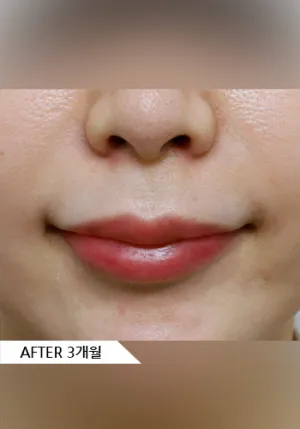 After