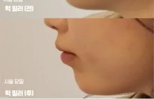 After