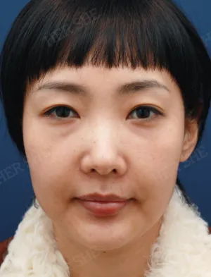 Before