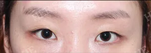 Before