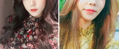 Уруулын булангийн филлер