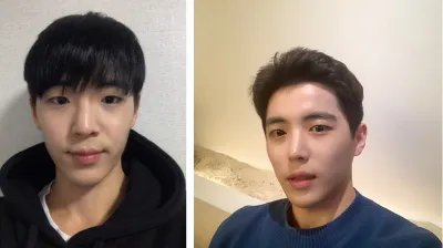 Би нүдний хэлбэр засах, зүсэлт хийлгэх, хамар мэс засал хийлгэсэн.