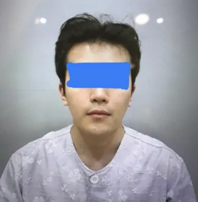 Дөрвөлжин эрүү, хацрын ясыг багасгах, урд эрүү, хальсан яс тайрах, Сугар гарагийн лазер, контурын тариа