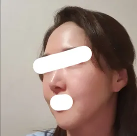 Нүүр өргөх дахин хагалгаа хийлгэсний дараа хуучин зургаа хараад баяртай байна ^^