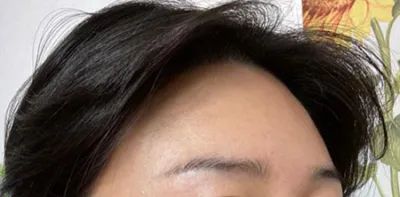 Духны өөх шилжүүлэн суулгах