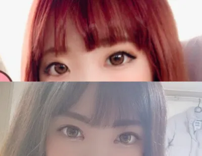 Давхар зовхи (булаг), урд зүсэлт