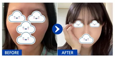 [Бабиток] Нүүрний хэлбэр засах / 3 дахь сар / Ник нэр: orini