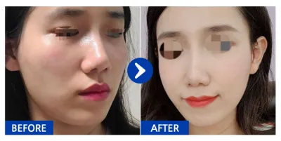 [Бабиток] Нүүрний хэлбэр засах / 3 дахь сар / Ник нэр: dbdbdla