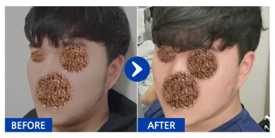 [Бабиток] Нүүрний хэлбэр засах / 3 дахь сар / Ник нэр: 안능웅