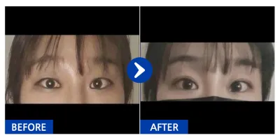 [Babytalk] Давхраа / 3 дахь сар / Ник нэр: tilia20