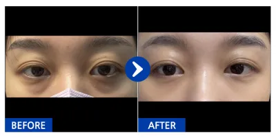 [Бабиток] Нүдний доод өөх засах / 1 дэх сар / Ник нэр: 눈눈엉옹