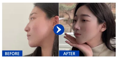 [Бабиток] Хамрын хагалгаа / 5 дахь сар / Ник нэр: atmospe