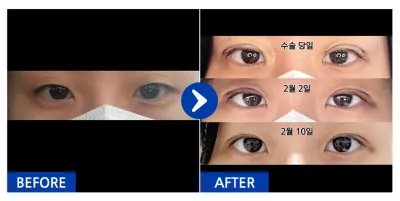 [Каннам Онни] Давхраа (жамаараа наалдах) / 1 дэх сар / Ник нэр: 활쏴비아