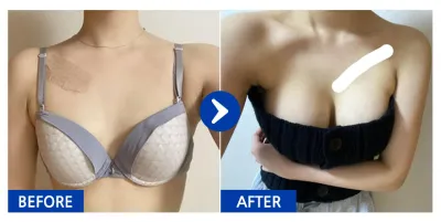 [Бабиток] Хөхний хагалгаа / 6 дахь сар / Ник нэр: 멜