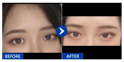 [Ганнам Онни] Байгалийн наалдац / 1 дэх сар / Никнэйм : 띠용ㅇㅅㅇ