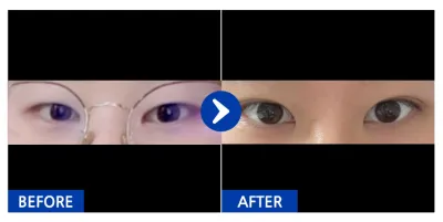 [Ганнам Онни] Давхраа (Байгалийн наалдац) / Никнэйм : juankim