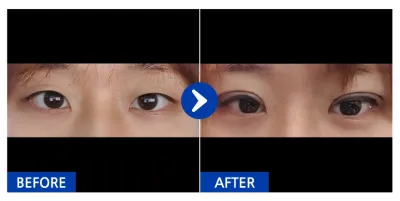 [Ганнам Онни] Байгалийн наалдац / 1 дэх сар / Никнэйм : ㅋㄱㅋㅋㄲ