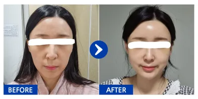 [Бабиток] Өөх шилжүүлэн