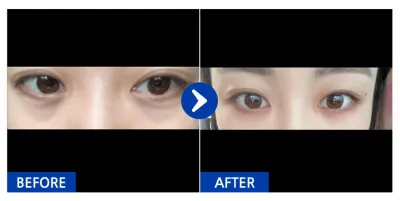 [Babytalk] Байгалийн наалдац / 2 долоо хоног / Никнэйм: 융박