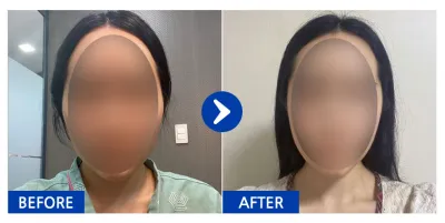 [Babytalk] Нүүрний хэлбэр засах / 1 сар / Никнэйм: 윰대딩