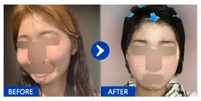 [Babytalk] Нүүрний хэлбэр засах / 1 сар / Никнэйм: 이이으루루루