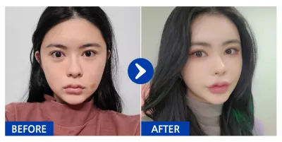 [Ганнам Унни] Өөх шилжүүлэн суулгах / 5 дахь сар / Никнейм: ooaa.a