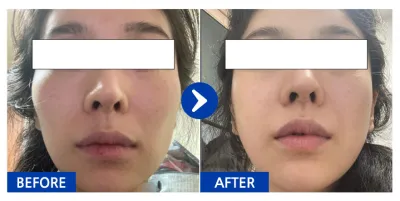 [Gangnam Unni] Хацрын яс / 1 сар / Никнэйм: 미닝메이드