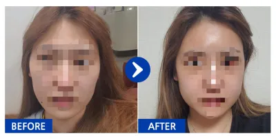 [Babytalk] Шанаа, Дөрвөлжин эрүү / 3 долоо хоног / Никнэйм: 223345