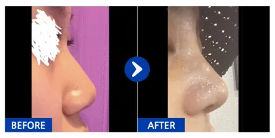 [Gangnam Unni] Хамар / 1 сар / Никнэйм: kirakira.s