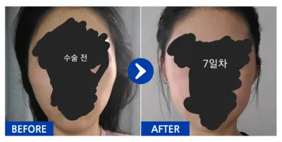 [Gangnam Unni] Шанаа / 1 сар / Никнэйм: 고기를위한고기