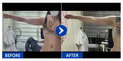 [Babytalk] Өөх соруулах / 1 сар / Никнэйм: 미튄토끼