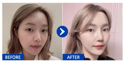 [Ганнам Онни] Хамрын дахин хагалгаа / 1 дэх