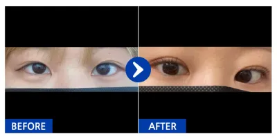 [Babytalk] Байгалийн наалдац (Давхраа) / 1 сар / Никнэйм: 당산미녀