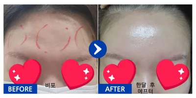 [Babytalk] Духны өөх шилжүүлэн суулгах / 1 сар / Никнэйм: 파파론